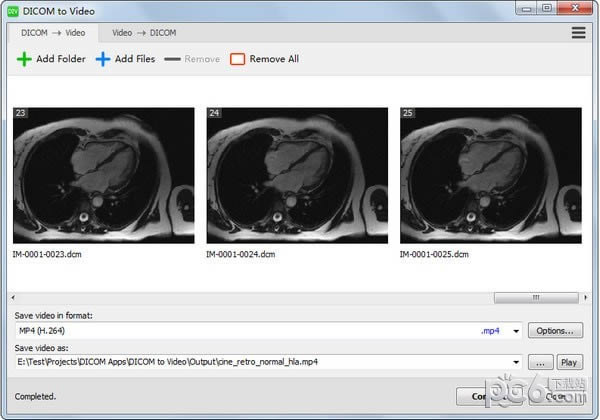 
DICOM to Video-DICOMתƵ-DICOM to Video v1.12.0ٷ汾